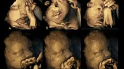 Δείτε τις αντιδράσεις του εμβρύου όταν η μητέρα καπνίζει-(VIDEO)
